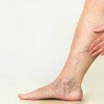 Varislerden Kurtulma Yöntemleri